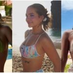 Celulite teen: como lidar com os furinhos na pele antes dos 18