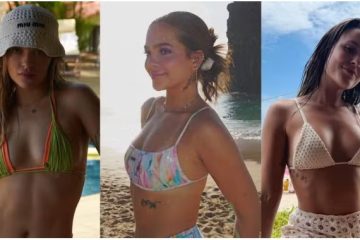 Celulite teen: como lidar com os furinhos na pele antes dos 18