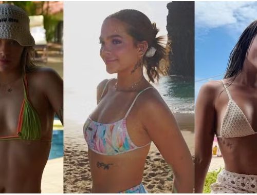 Celulite teen: como lidar com os furinhos na pele antes dos 18